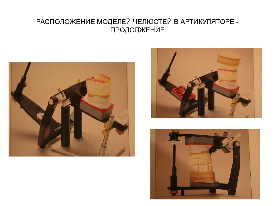 Презентация биомеханика нижней челюсти