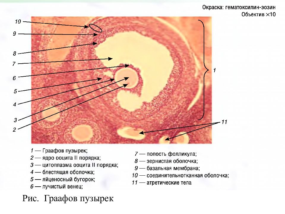 Яичник у млекопитающих. Граафов пузырек строение гистология. Строение фолликула яичника млекопитающего. Граафов пузырек гистология. Срез яичника млекопитающего схема.