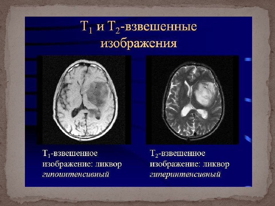 Режимы мрт презентация