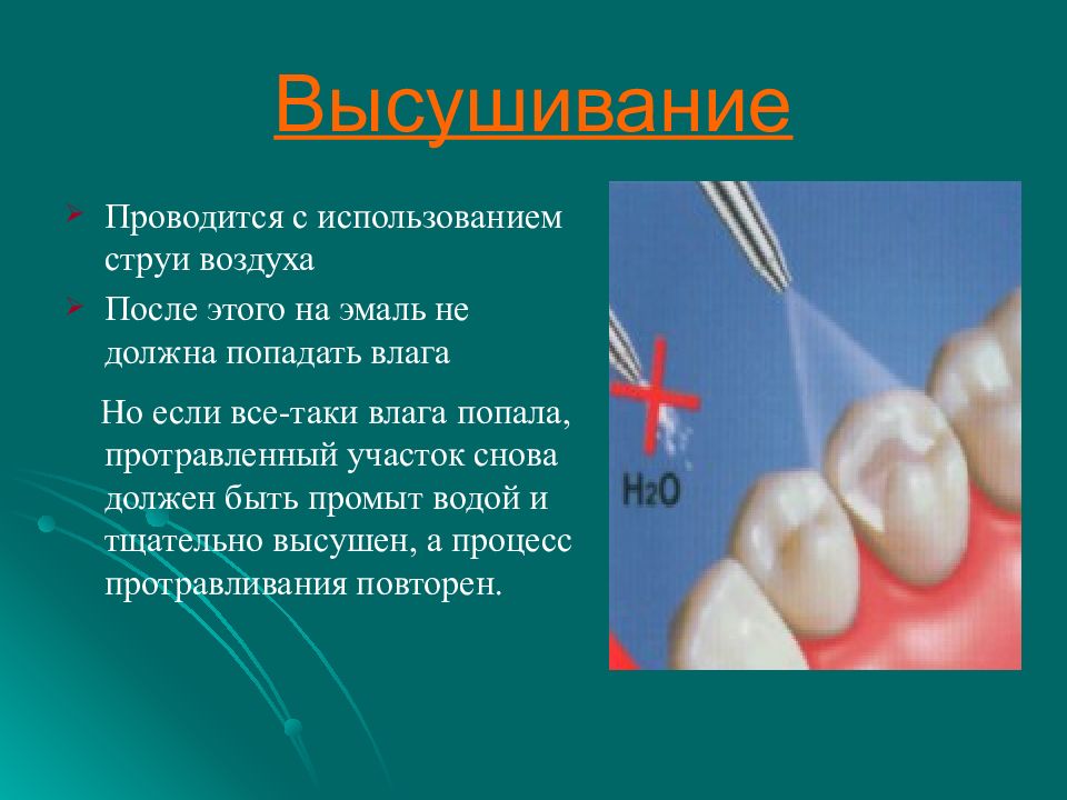 Проводились с использованием. Высушивание зуба струей воздуха. Методы высушивания зуб. Использование струи воздуха при высушивании канала.