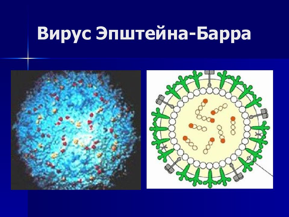 Вирус эпштейна барра презентация