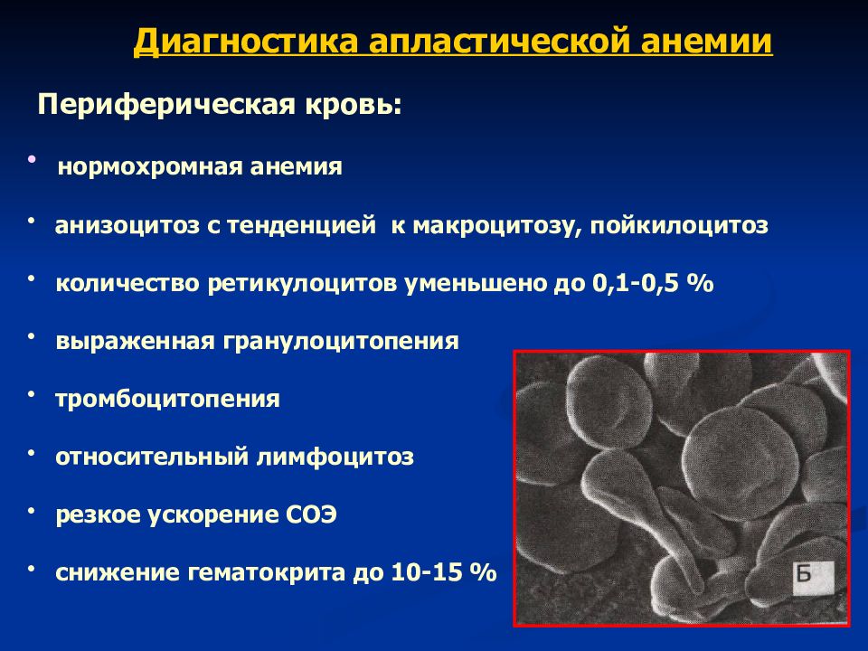 Картина панцитопении и агранулоцитоза характерна для следующего периода олб