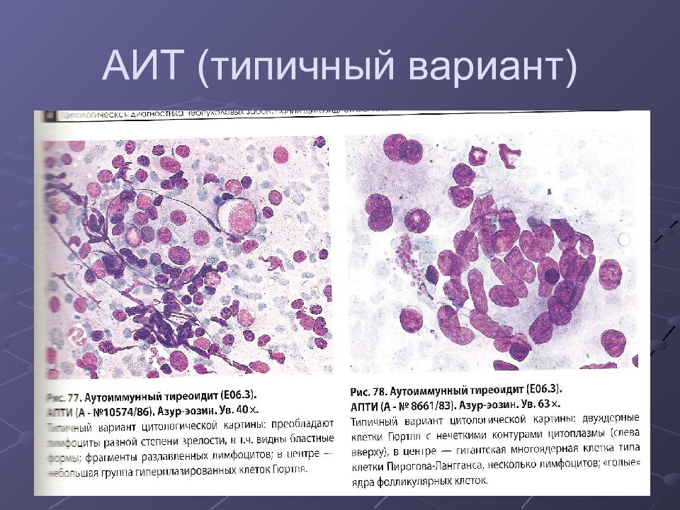 Цитологическая картина коллоидного узла