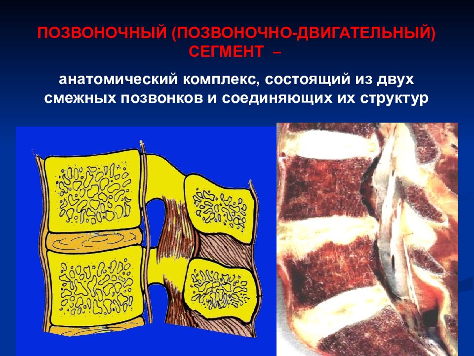 Двигательный сегмент. Двигательный сегмент позвоночника. Позвонково двигательный сегмент это. Смежных позвонков. Сегментирование позвоночника.
