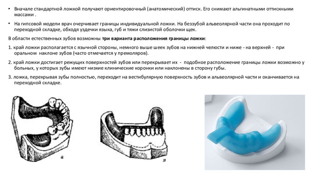 Показания к пластиночным протезам. Требования к опорным зубам. Способы фиксации частичных съемных пластиночных протезов. Требования к гипсовой модели.