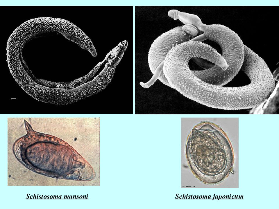 Schistosoma japonicum. Schistosoma japonicum яйцо. Schistosoma mansoni яйца. Шистосома haematobium. Шистосома Мансона s. mansoni.