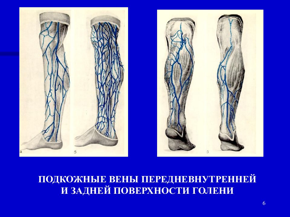 Подкожные вены. Большая подкожная Вена нижней конечности. Большая подкожная Вена голени. Малая подкожная Вена ноги отток. Большая подкожная Вена и малая подкожная Вена.