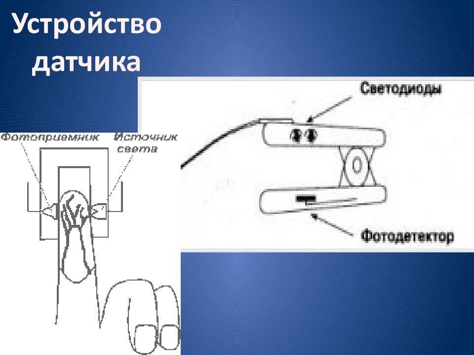 Пульсоксиметр схема. Пульсоксиметр ардуино схем. Пульсоксиметр схема. Плетизмография пульсоксиметр. Схема пульсоксиметра.
