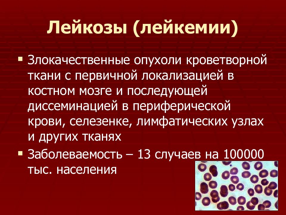 Бензольный лейкоз презентация