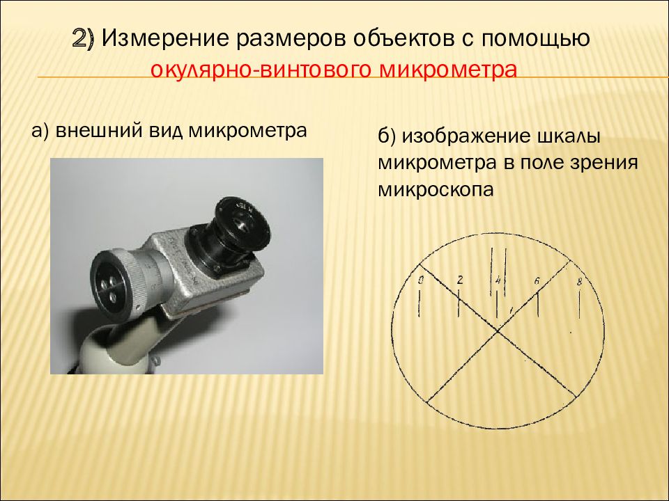 По изображению с микроскопа в препарате угла глаза при малом увеличении видна крупная оксифильная