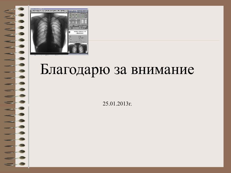 Восстания 1 флюорография. Флюорография список литературы. Флюорография язык цветов книга. Восстания 1 флюорография цена.