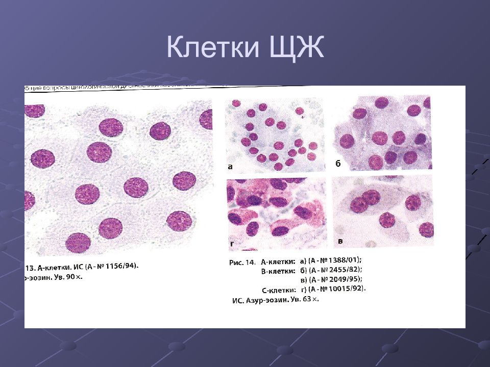 Щитовидная железа цитологическая картина