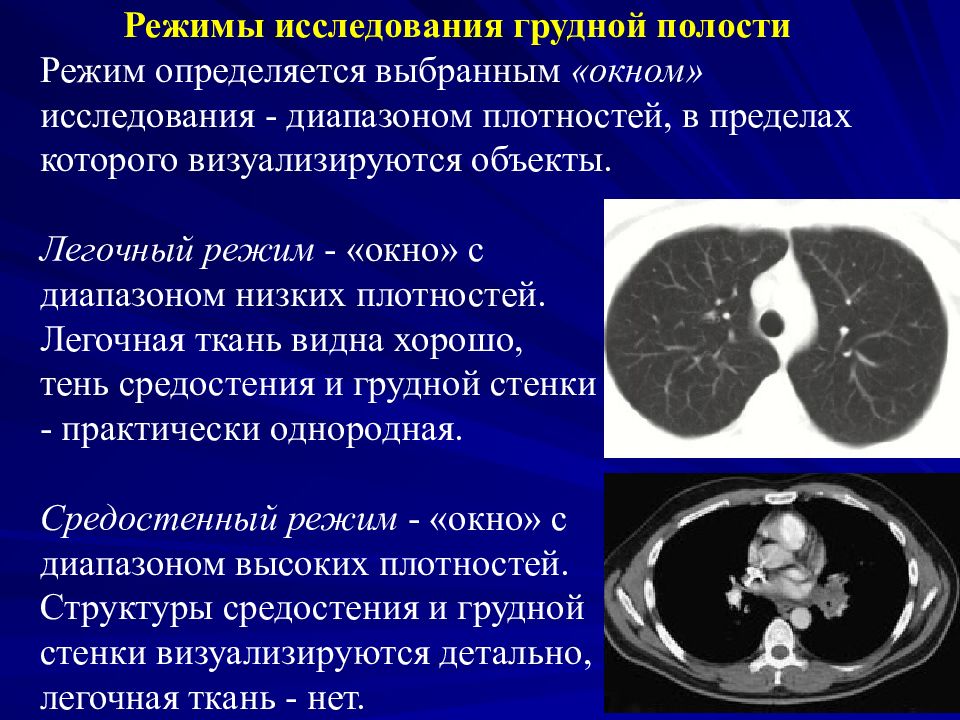 Режим исследования. Исследование грудной полости. Режим исследования окна.