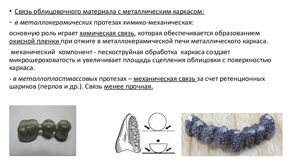 Изготовление мостовидных протезов презентация