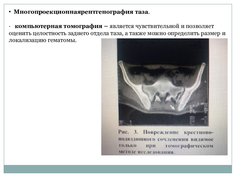 Травма таза презентация