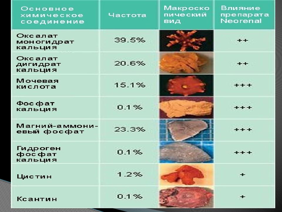 Сделать анализ камня из почек