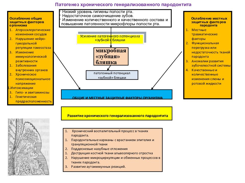 Патогенез пародонта. Патогенез хронического пародонтита. Патогенез заболеваний пародонта схема. Патогенез генерализованного пародонтита. Схема патогенеза воспалительных заболеваний пародонта.