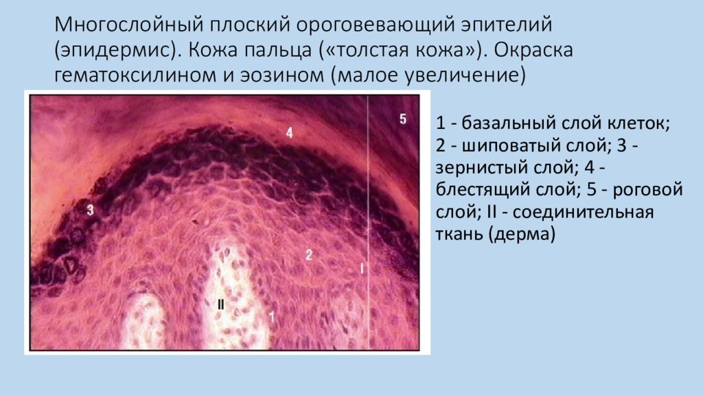 Многослойный ороговевающий эпителий