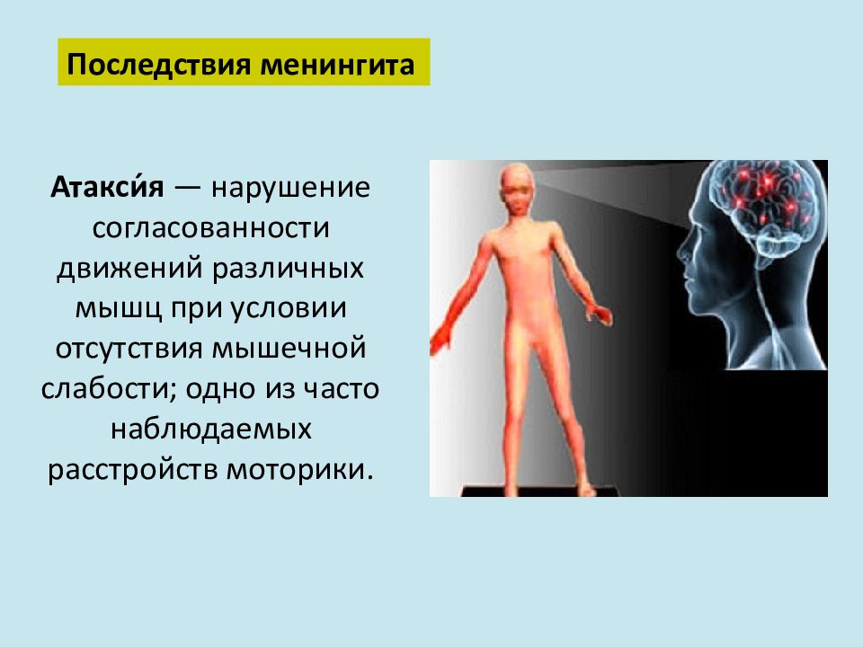 Менингит презентация казакша