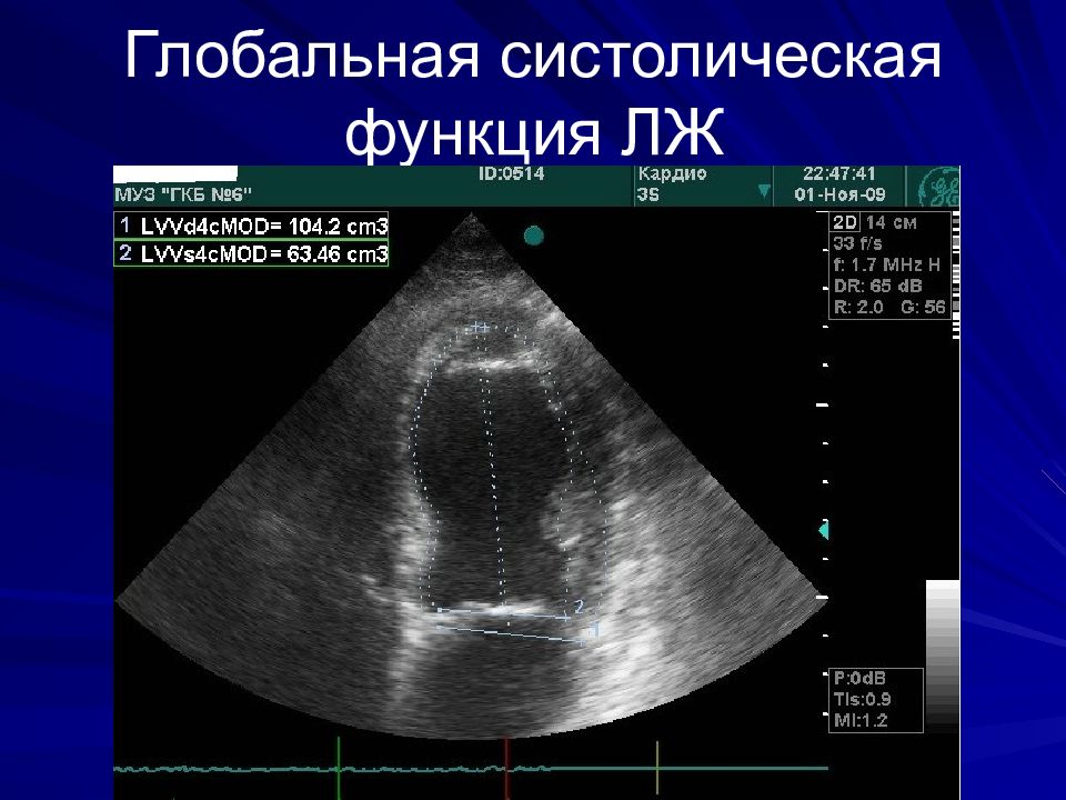 Учебный план эхокардиография