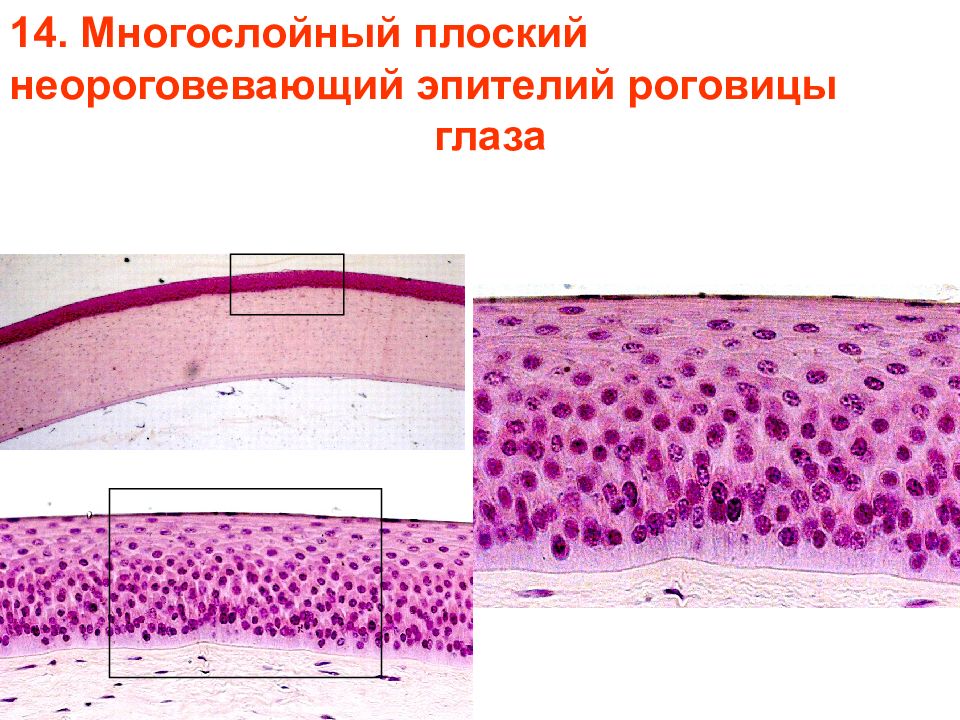 Роговица гистология. Многослойный плоский эпителий роговицы коровы. Многослойный неороговевающий эпителий роговицы. Многослойный плоский неороговевающий эпителий пуговицы глаза. Многослойный плоский неороговевающий эпителий роговицы глаза.