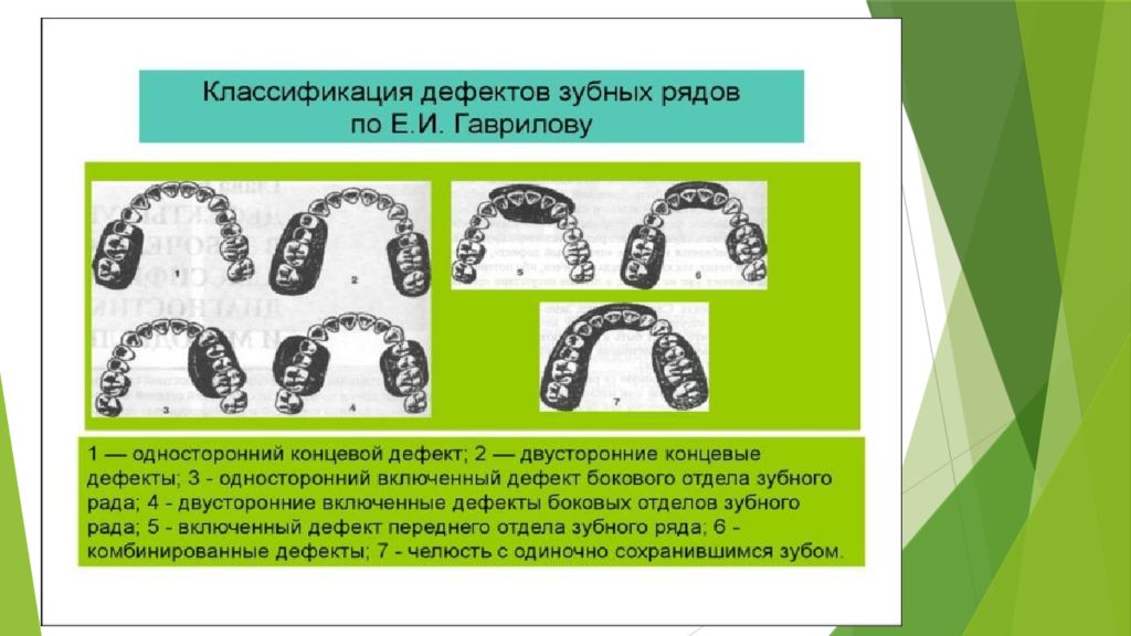 Классификация дефектов зубных рядов