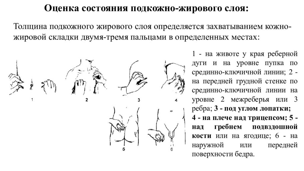 Толщина складок. Оценка состояния кожи и подкожно-жировой клетчатки у грудных детей. Оценка подкожно жирового слоя у новорожденных. Оценка подкожно жировой клетчатки. Методика исследования подкожно-жировой клетчатки.