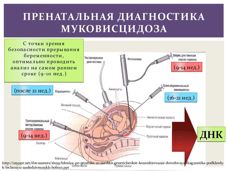 Диагностика муковисцидоза презентация