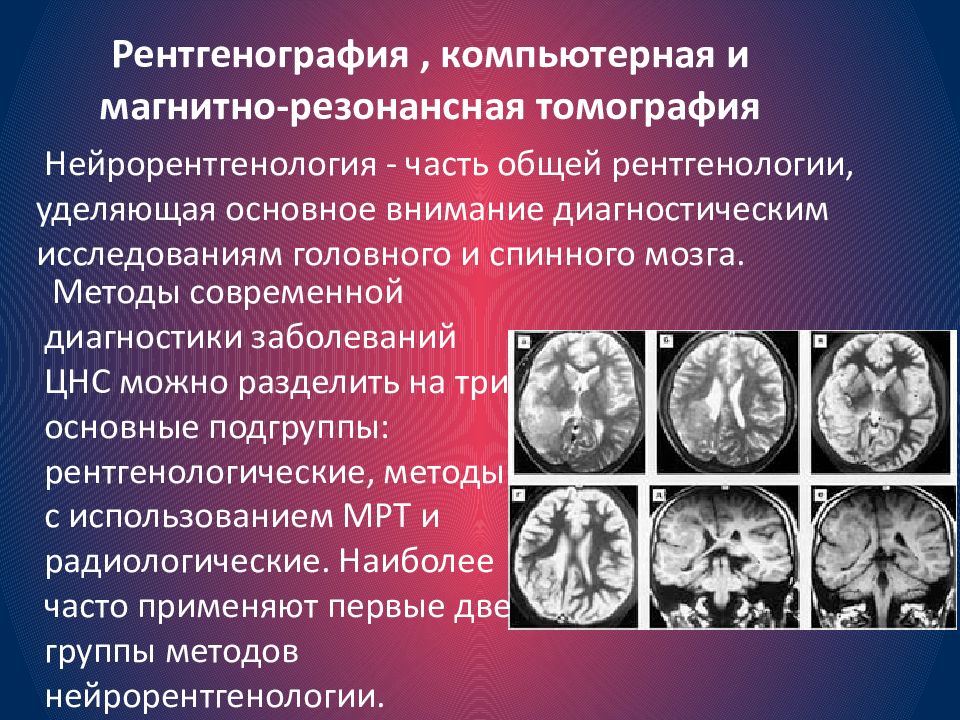 Методы исследования в неврологии презентация