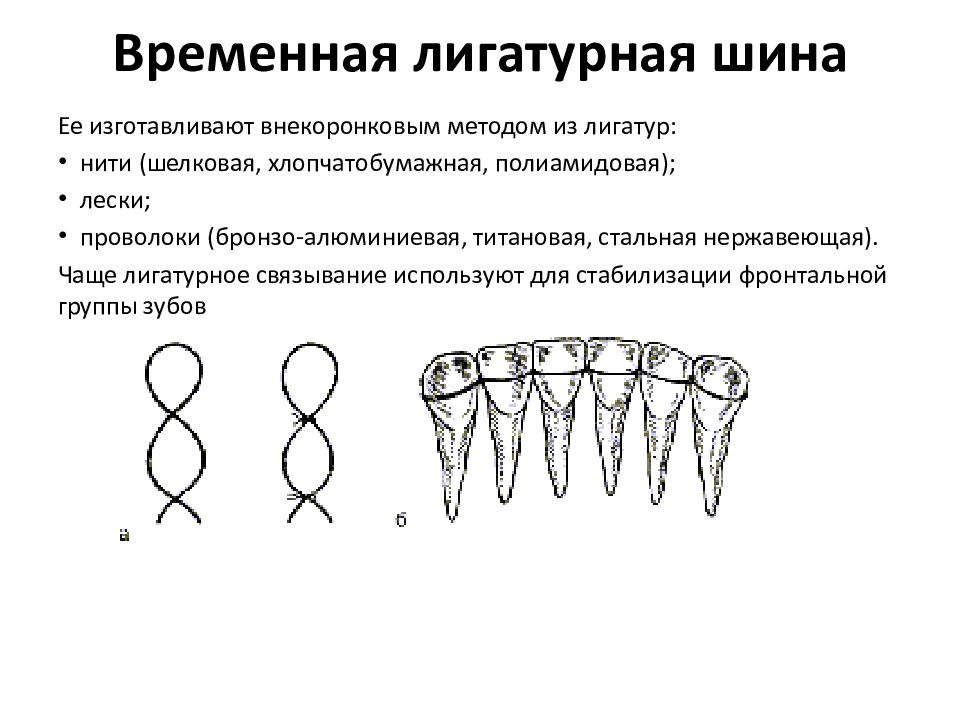 Схема сошлифовывания гипса на модели при изготовлении иммедиат протеза