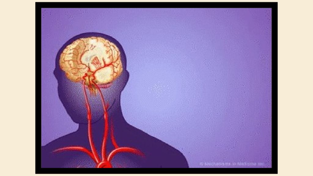 Ишемия нерва. Анимированный мозг. Головной мозг анимация. Ишемический инсульт гиф.