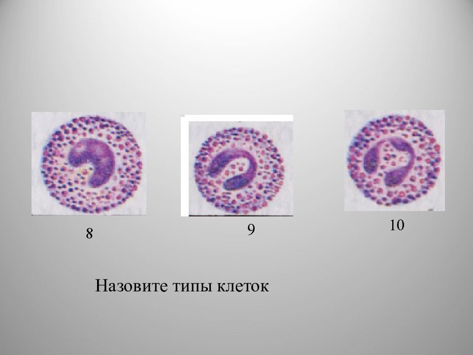 Палочкоядерные. Палочкоядерный нейтрофил. Палочковидный нейтрофилы. Палочкоядерные гранулоциты. Палочкоядерный гранулоцит.