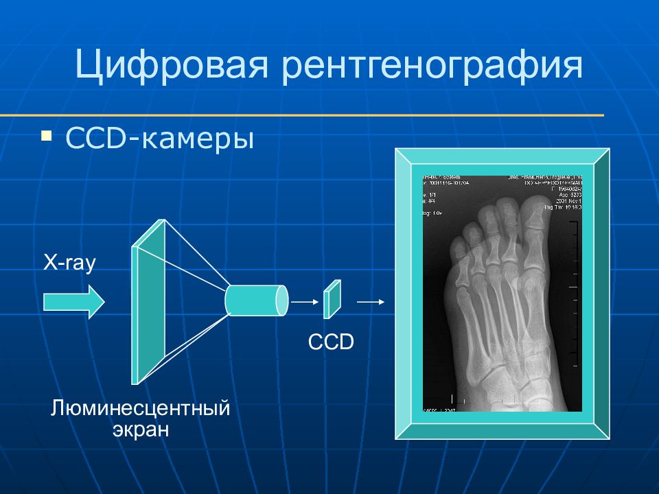 Единица цифрового изображения на рентгенограмме это