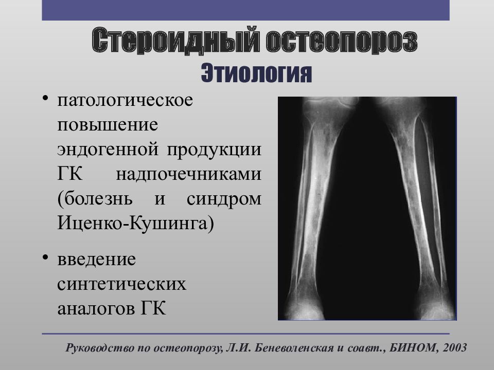 Презентация по теме остеопороз