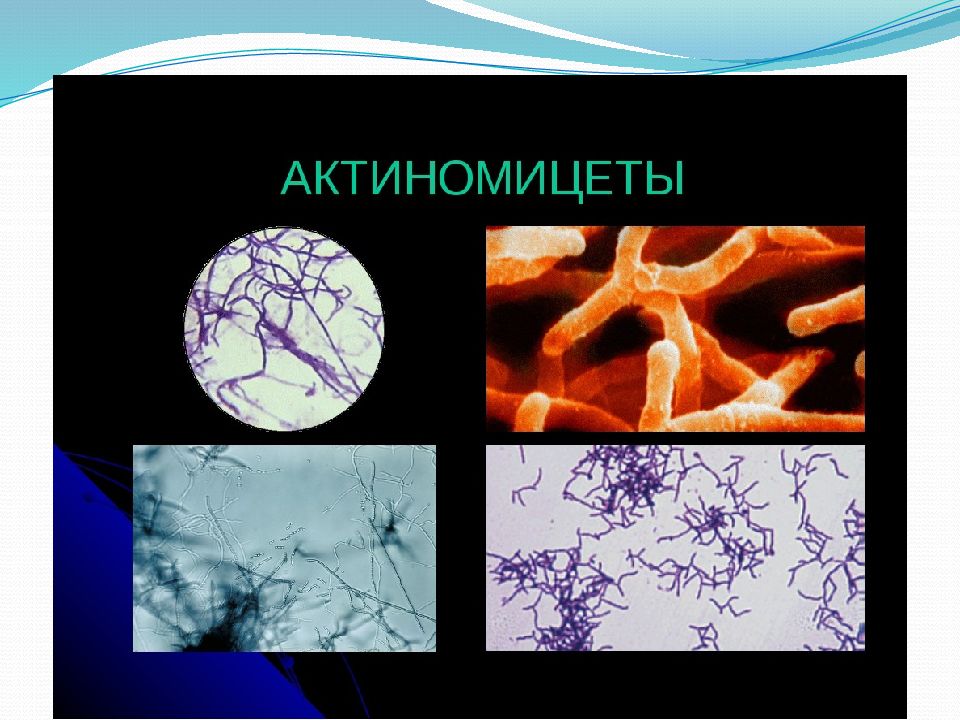 Актиномицеты микробиология презентация