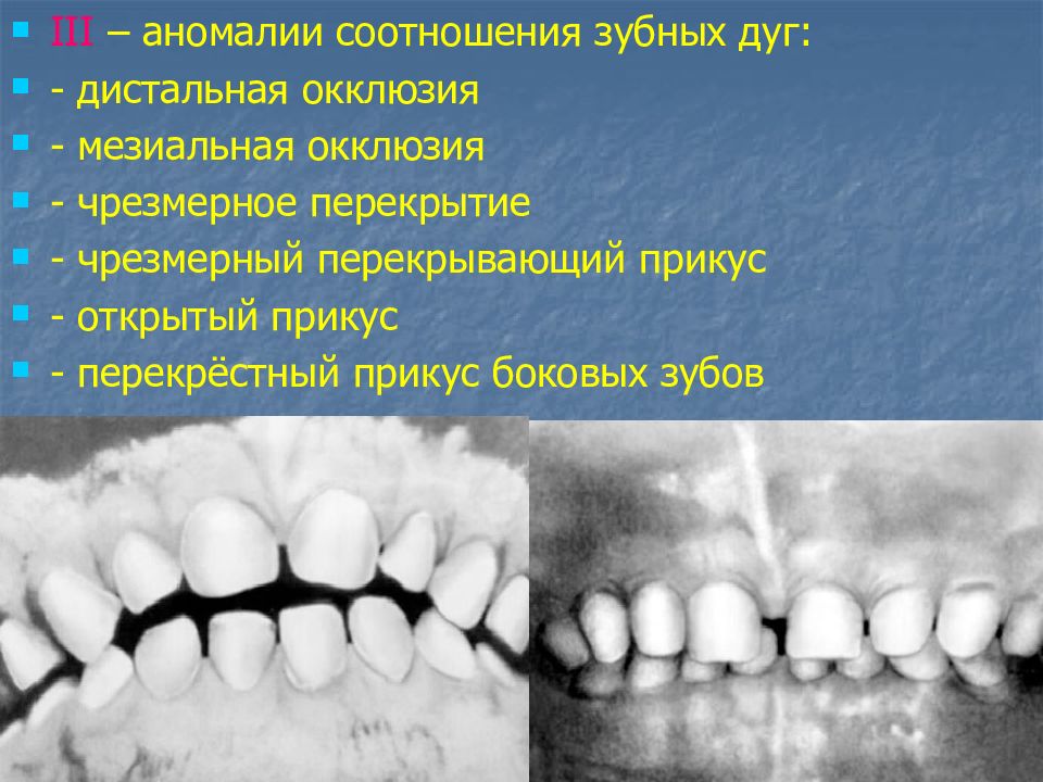 Мезиальная окклюзия презентация