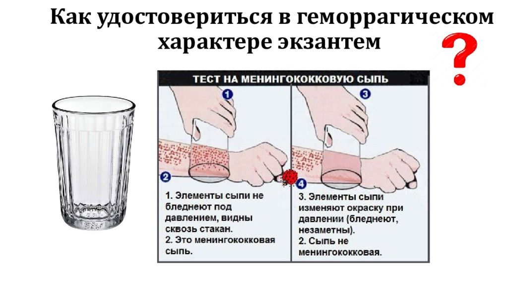 Удостовериться. Геморрагические пятна. Тест со стаканом при менингите. Сыпь геморрагического характера.