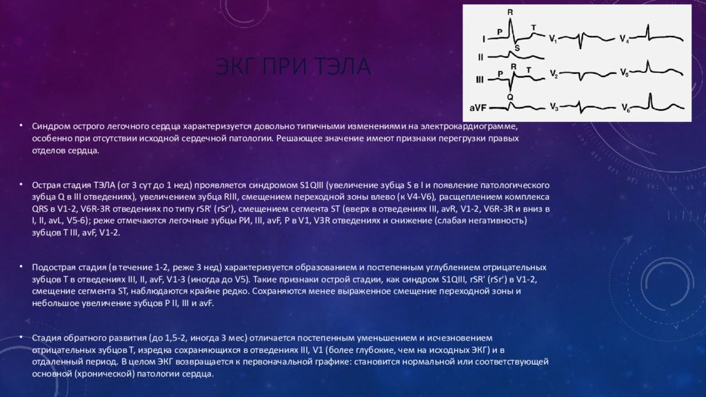 Экг при тэла картинки