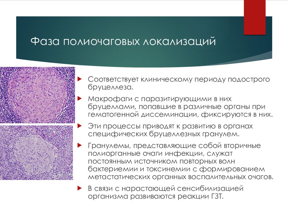 Хронический бруцеллез презентация