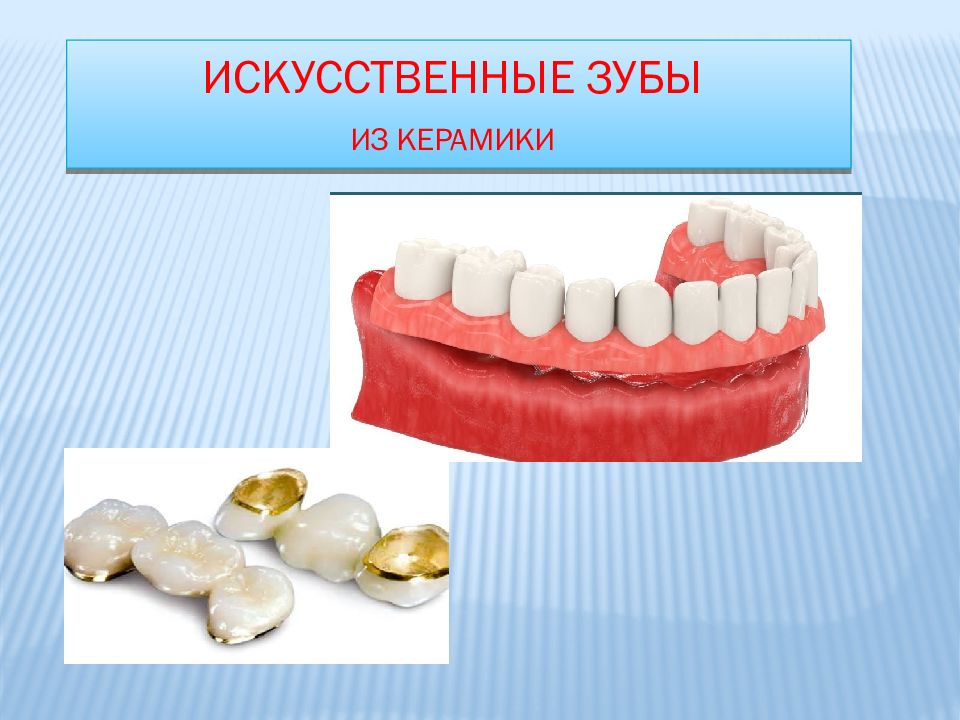 Стоматологическая керамика презентация