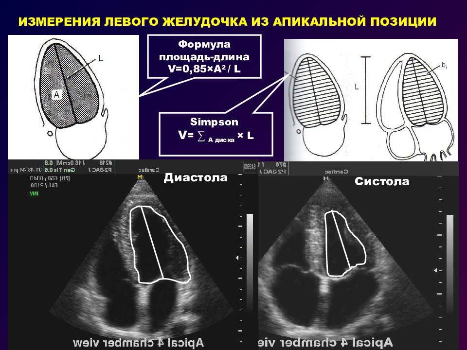 Эхокардиография сердца это. Эхокардиография измерения. Измерения левого желудочка. Диастола левого желудочка. Эхокардиография физиология.