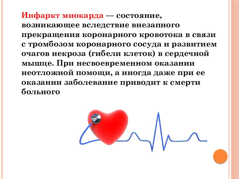 Презентация инфаркт миокарда лечение