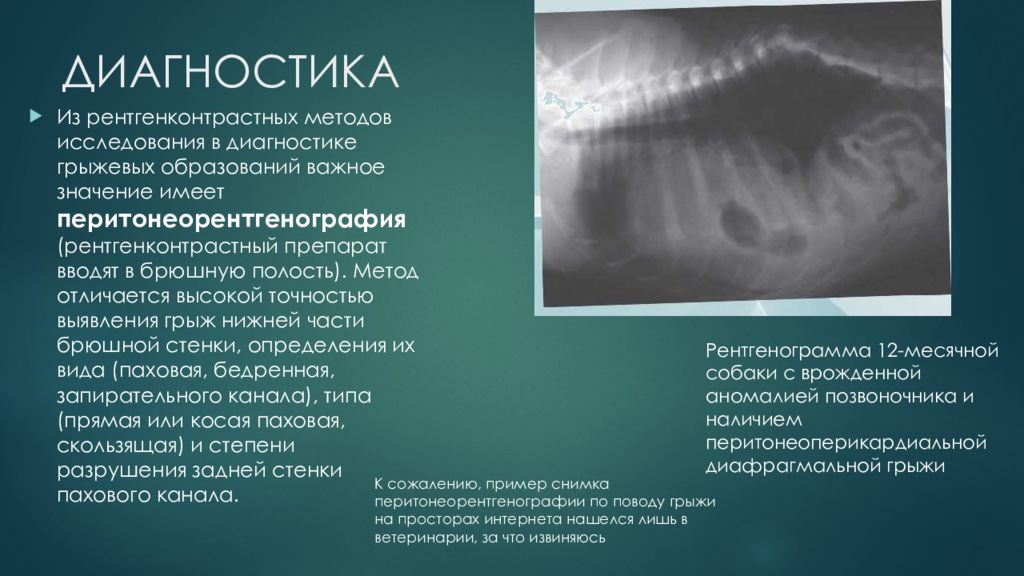 Грыжа передней брюшной стенки. Методы диагностики грыж. Диагностика грыж передней брюшной стенки. Методы обследования передней брюшной стенки. Инструментальные методы исследования грыж.