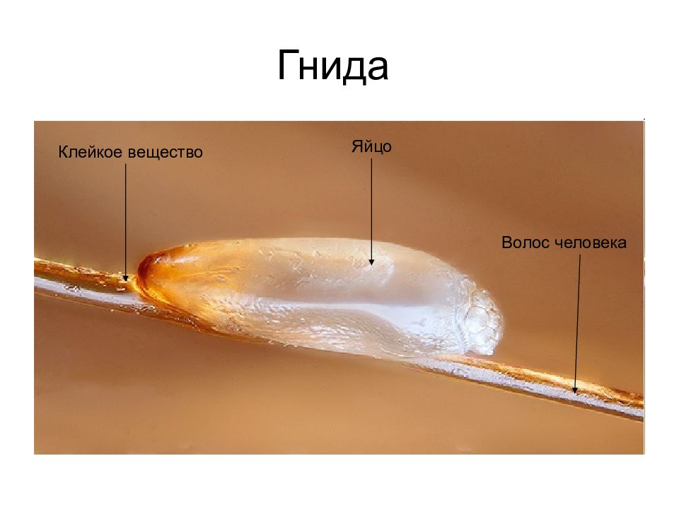 Липкое слово. Гнида строение. Яйца вшей строение.