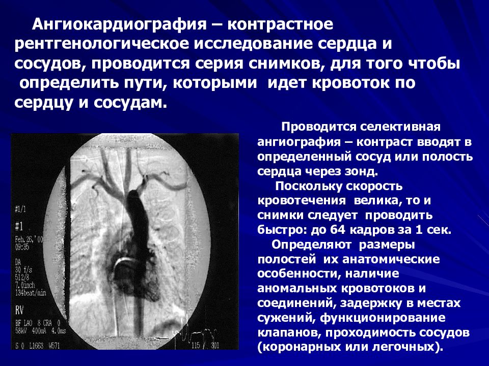 Контраст исследования. Рентгенологическое исследование сердца. Контрастное исследование сосудов. Рентгенологический метод исследования сердца. Методики рентгенологического исследования сердца и крупных сосудов.