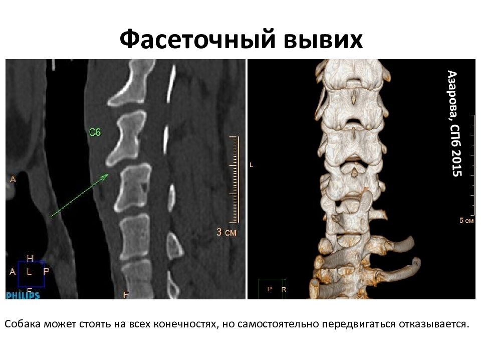 Компьютерная томография в неврологии презентация