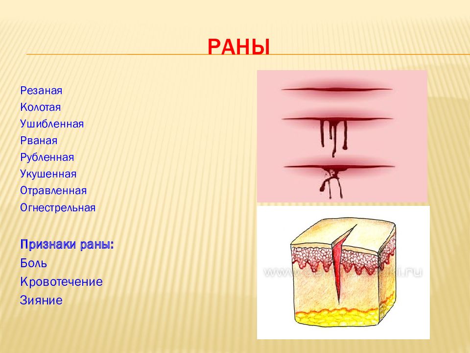 Признаки раны