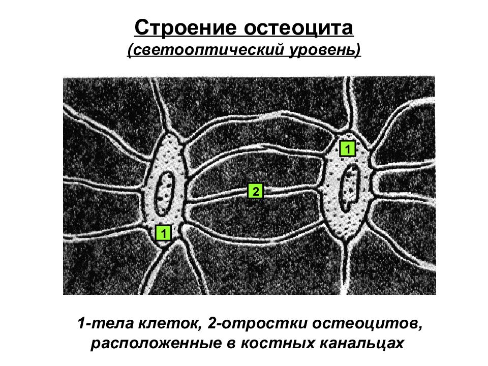 Остеоцит. Остеоцит строение. Клетки остеоциты. Отростки остеоцитов. Остеоцит Электронограмма.