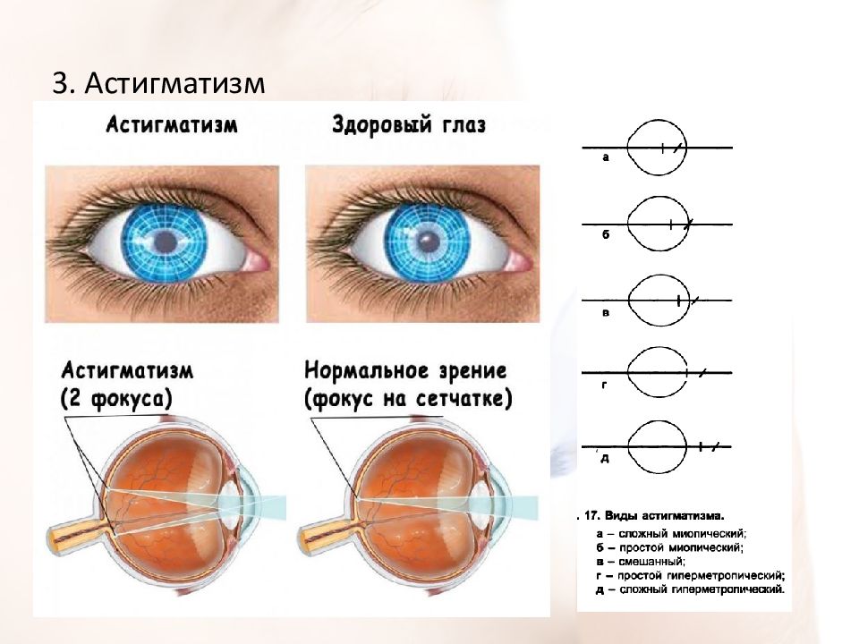 Почему линзы увеличивают изображение