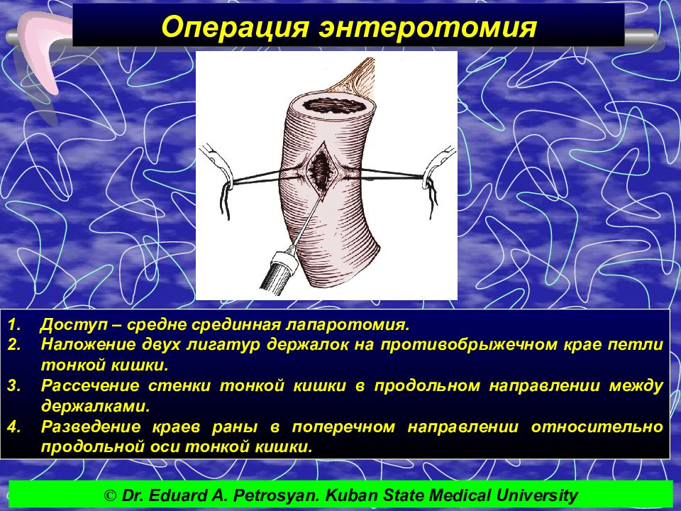 Презентация по тонкой кишке